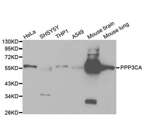 Anti-PPP3CA Antibody from Bioworld Technology (BS6114) - Antibodies.com
