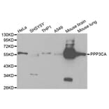 Anti-PPP3CA Antibody from Bioworld Technology (BS6114) - Antibodies.com