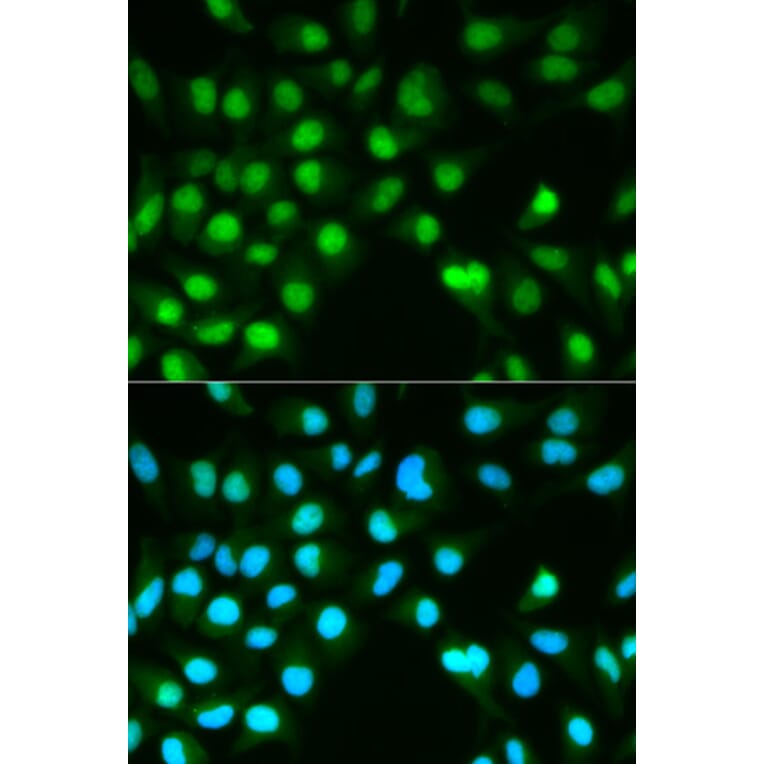 Anti-PPP3CA Antibody from Bioworld Technology (BS6114) - Antibodies.com
