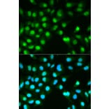 Anti-PPP3CA Antibody from Bioworld Technology (BS6114) - Antibodies.com