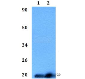 Anti-C9 Antibody from Bioworld Technology (BS61143) - Antibodies.com