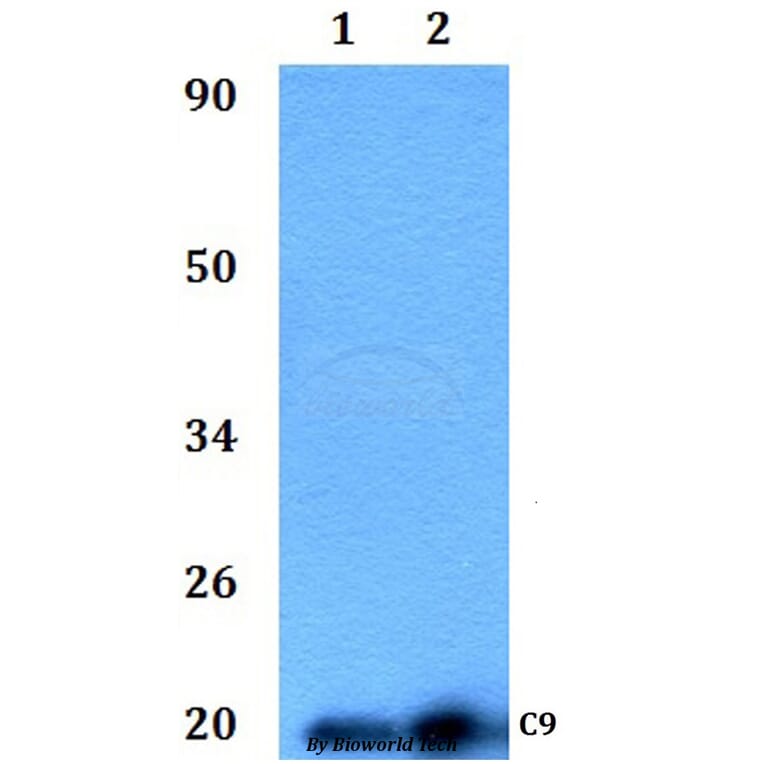 Anti-C9 Antibody from Bioworld Technology (BS61143) - Antibodies.com