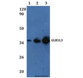 Anti-GLB1L3 Antibody from Bioworld Technology (BS61145) - Antibodies.com