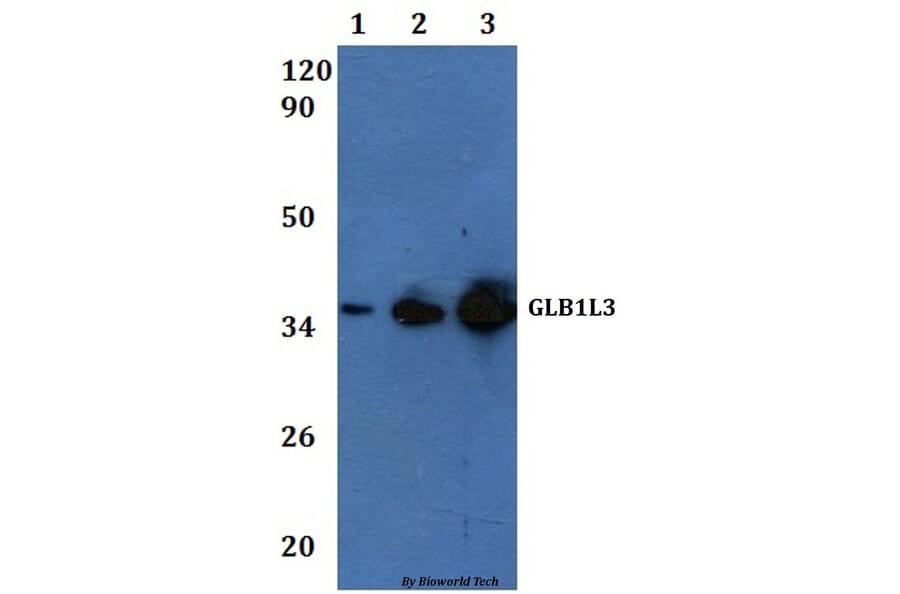 Anti-GLB1L3 Antibody from Bioworld Technology (BS61145) - Antibodies.com
