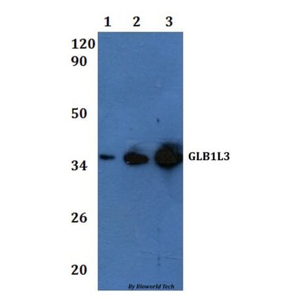 Anti-GLB1L3 Antibody from Bioworld Technology (BS61145) - Antibodies.com
