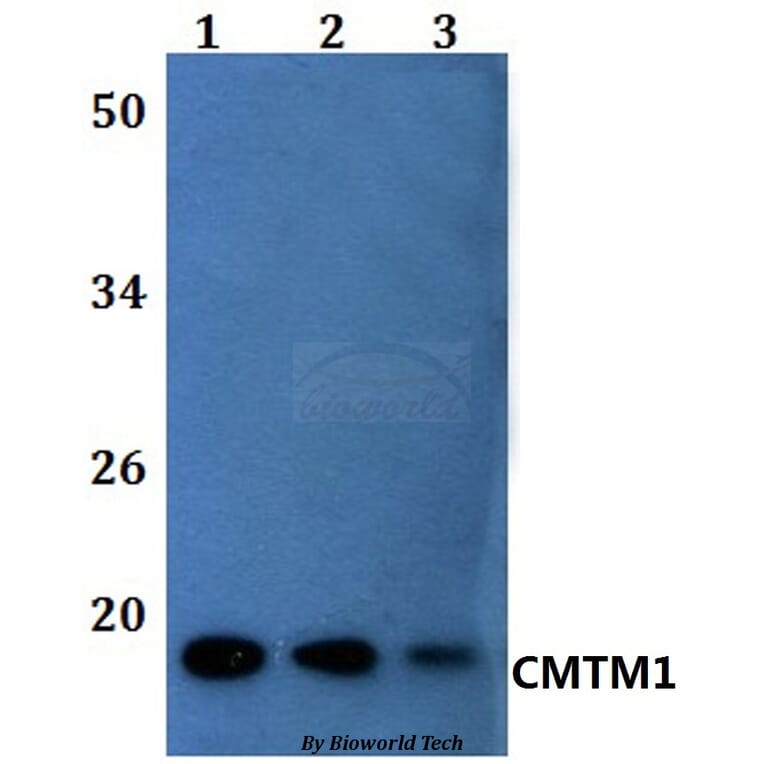 Anti-CMTM1 Antibody from Bioworld Technology (BS61155) - Antibodies.com