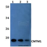 Anti-CMTM1 Antibody from Bioworld Technology (BS61155) - Antibodies.com