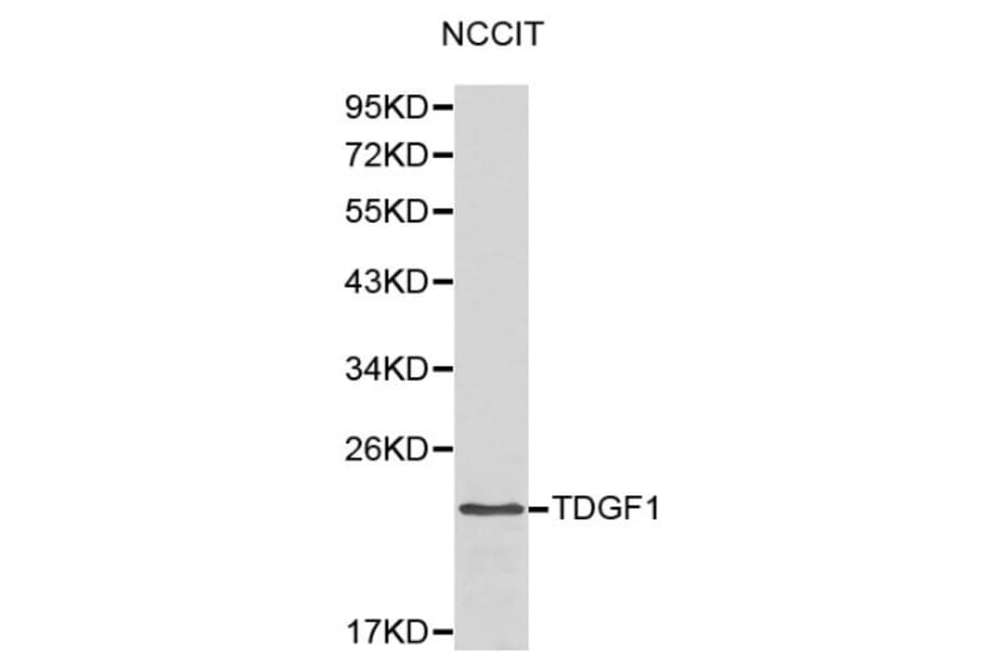 Anti-TDGF1 Antibody from Bioworld Technology (BS6116) - Antibodies.com