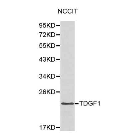 Anti-TDGF1 Antibody from Bioworld Technology (BS6116) - Antibodies.com