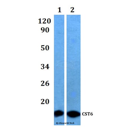 Anti-CST6 Antibody from Bioworld Technology (BS61167) - Antibodies.com