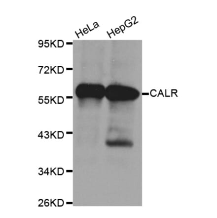 Anti-Calregulin Antibody from Bioworld Technology (BS6118) - Antibodies.com