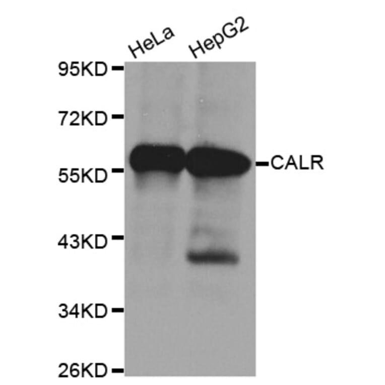 Anti-Calregulin Antibody from Bioworld Technology (BS6118) - Antibodies.com