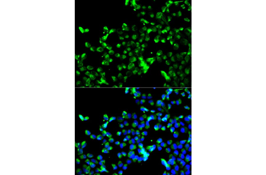 Anti-Calregulin Antibody from Bioworld Technology (BS6118) - Antibodies.com