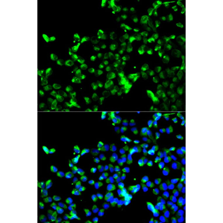 Anti-Calregulin Antibody from Bioworld Technology (BS6118) - Antibodies.com