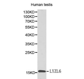 Anti-LYZL6 Antibody from Bioworld Technology (BS6119) - Antibodies.com