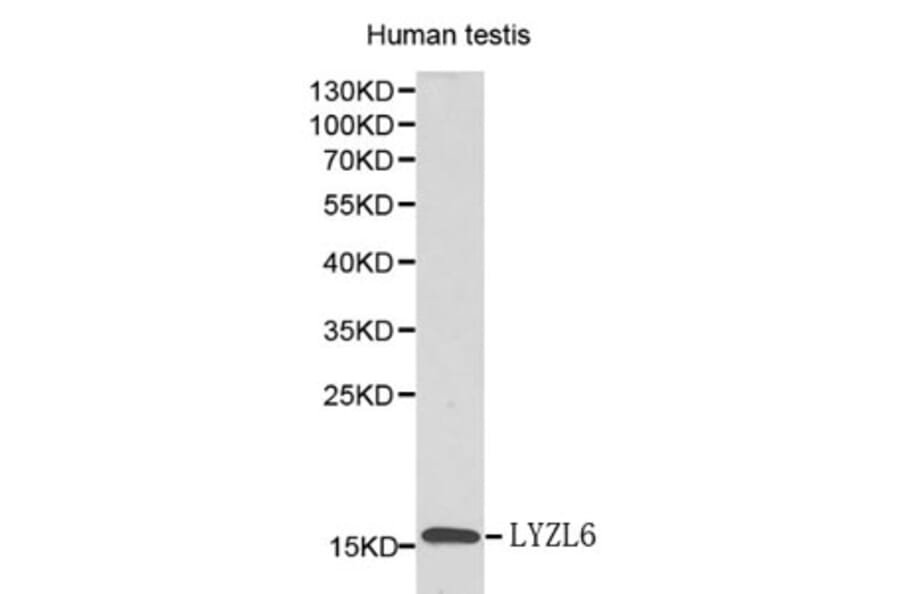 Anti-LYZL6 Antibody from Bioworld Technology (BS6119) - Antibodies.com