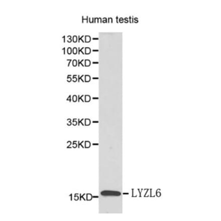Anti-LYZL6 Antibody from Bioworld Technology (BS6119) - Antibodies.com