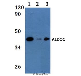 Anti-ALDOC Antibody from Bioworld Technology (BS61191) - Antibodies.com