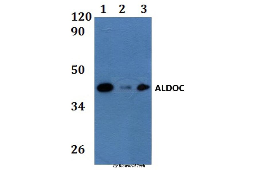 Anti-ALDOC Antibody from Bioworld Technology (BS61191) - Antibodies.com