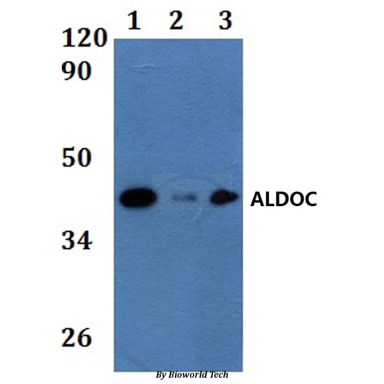Anti-ALDOC Antibody from Bioworld Technology (BS61191) - Antibodies.com