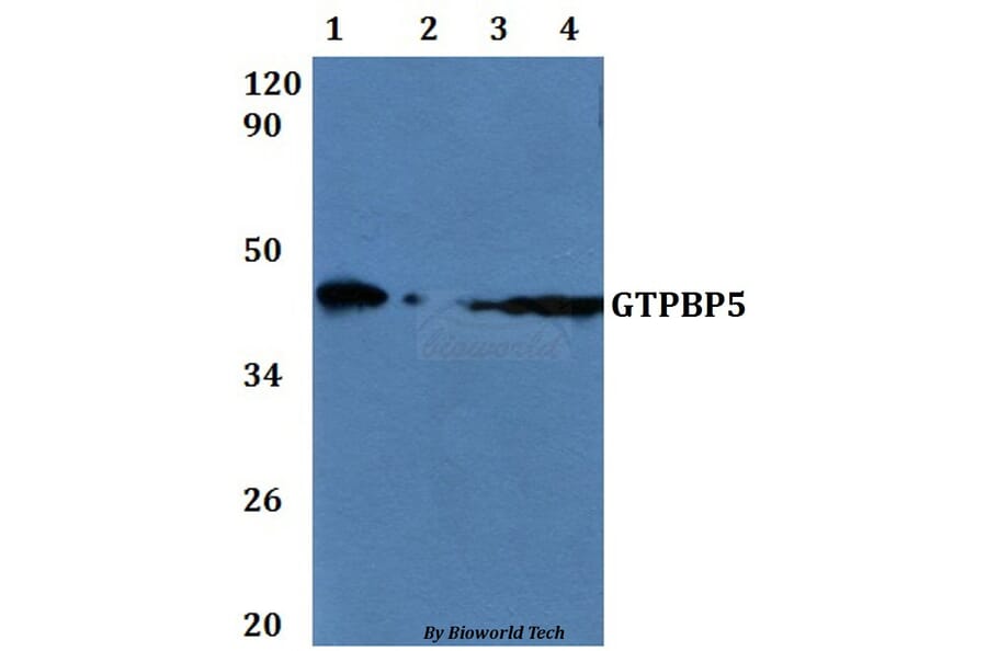 Anti-GTPBP5 Antibody from Bioworld Technology (BS61198) - Antibodies.com
