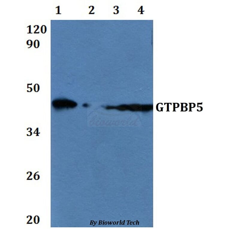 Anti-GTPBP5 Antibody from Bioworld Technology (BS61198) - Antibodies.com