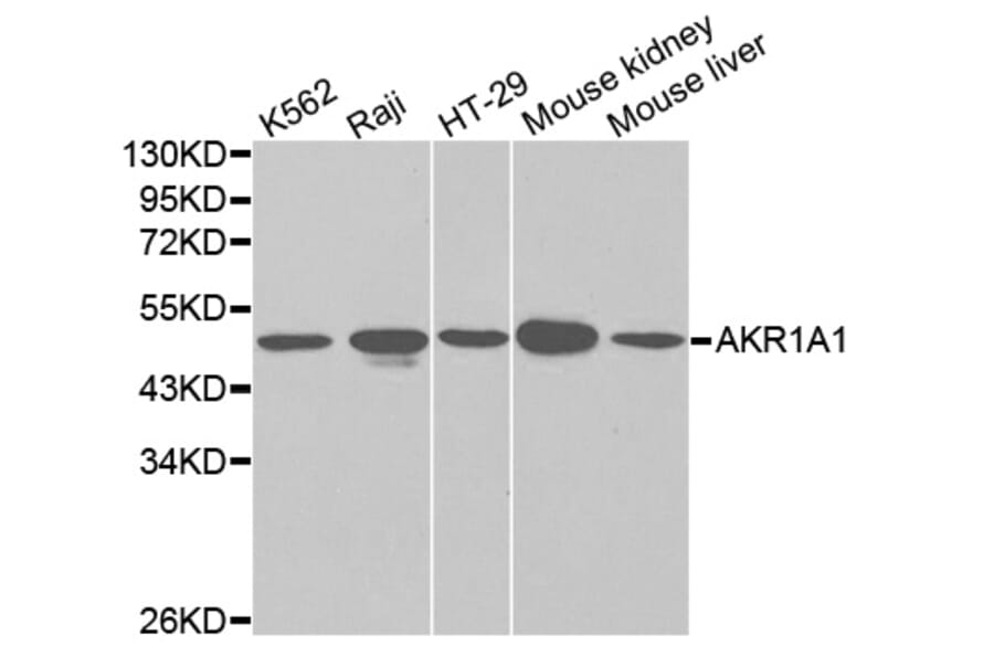 Anti-AKR1A1 Antibody from Bioworld Technology (BS6120) - Antibodies.com
