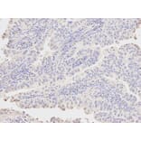 Anti-AKR1A1 Antibody from Bioworld Technology (BS6120) - Antibodies.com