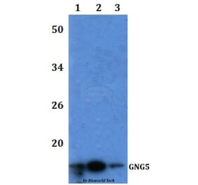 Anti-GNG5 Antibody from Bioworld Technology (BS61200) - Antibodies.com