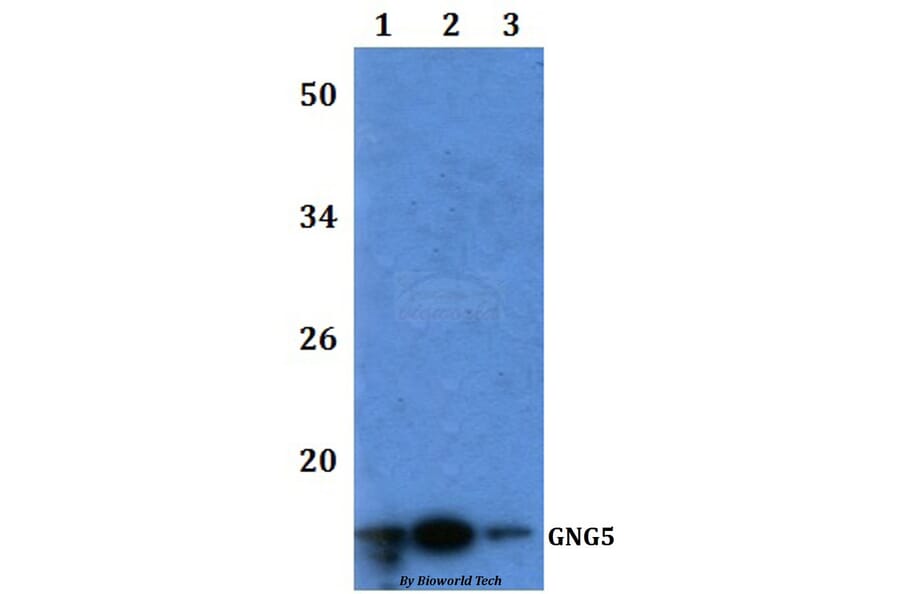 Anti-GNG5 Antibody from Bioworld Technology (BS61200) - Antibodies.com