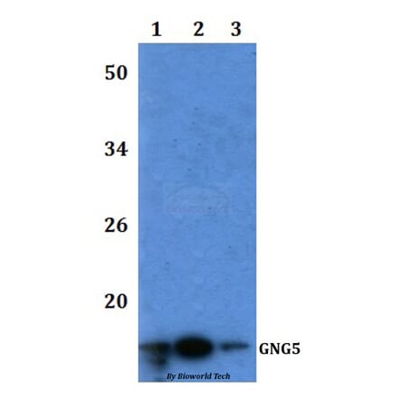 Anti-GNG5 Antibody from Bioworld Technology (BS61200) - Antibodies.com