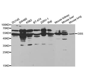 Anti-GSS Antibody from Bioworld Technology (BS6121) - Antibodies.com