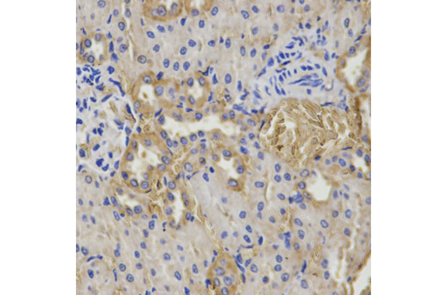 Anti-GSS Antibody from Bioworld Technology (BS6121) - Antibodies.com