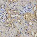 Anti-GSS Antibody from Bioworld Technology (BS6121) - Antibodies.com