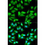Anti-GSS Antibody from Bioworld Technology (BS6121) - Antibodies.com