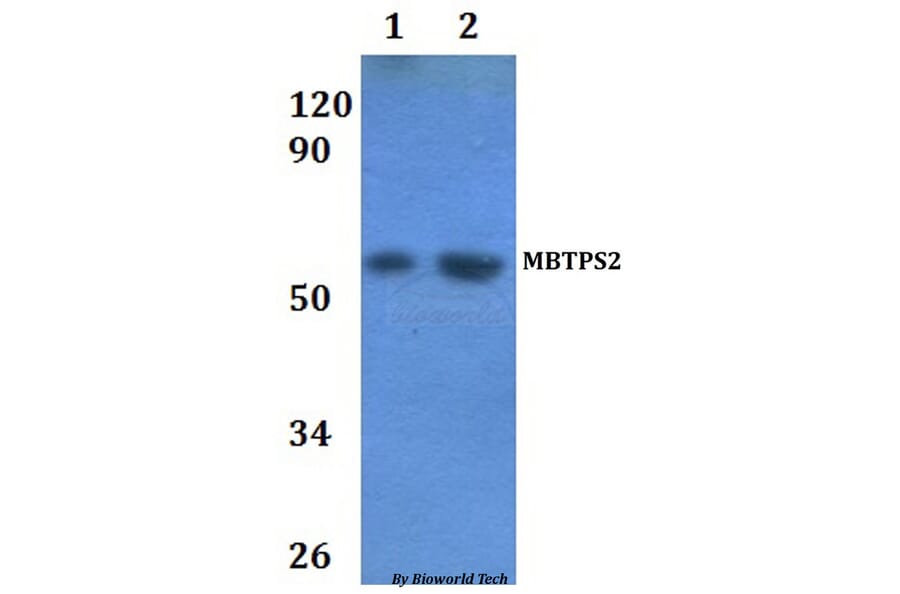 Anti-MBTPS2 Antibody from Bioworld Technology (BS61210) - Antibodies.com