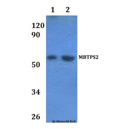Anti-MBTPS2 Antibody from Bioworld Technology (BS61210) - Antibodies.com