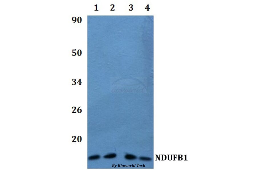 Anti-NDUFB1 Antibody from Bioworld Technology (BS61217) - Antibodies.com