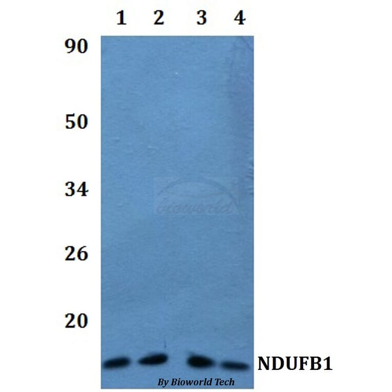 Anti-NDUFB1 Antibody from Bioworld Technology (BS61217) - Antibodies.com