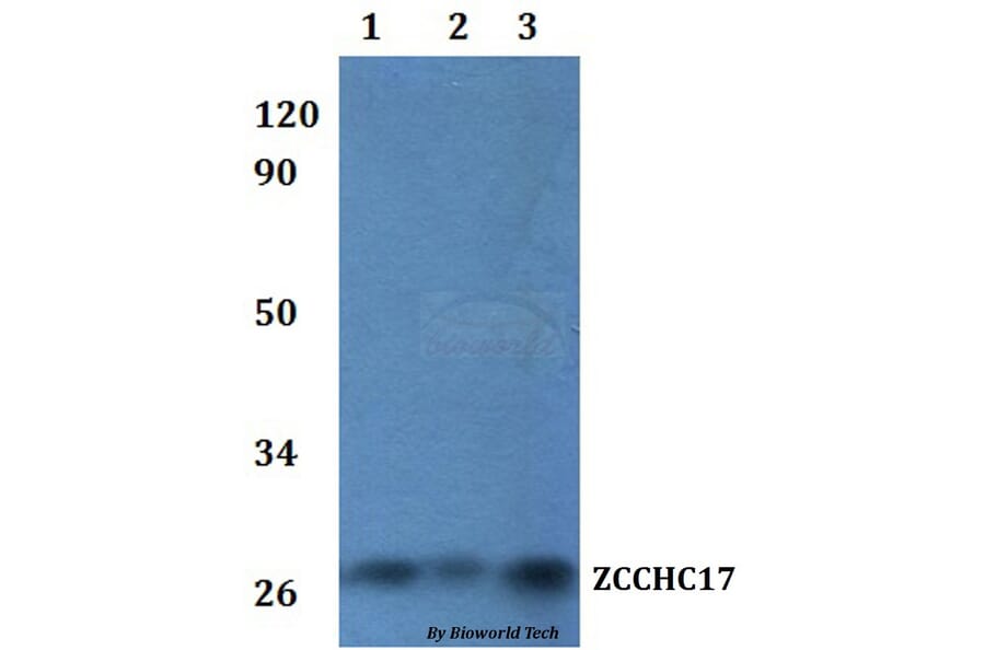 Anti-ZCCHC17 Antibody from Bioworld Technology (BS61229) - Antibodies.com