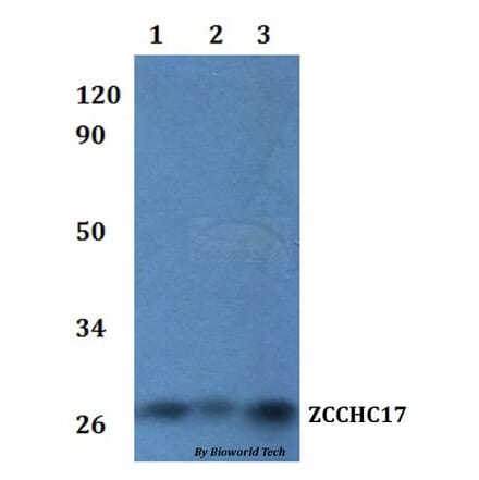 Anti-ZCCHC17 Antibody from Bioworld Technology (BS61229) - Antibodies.com