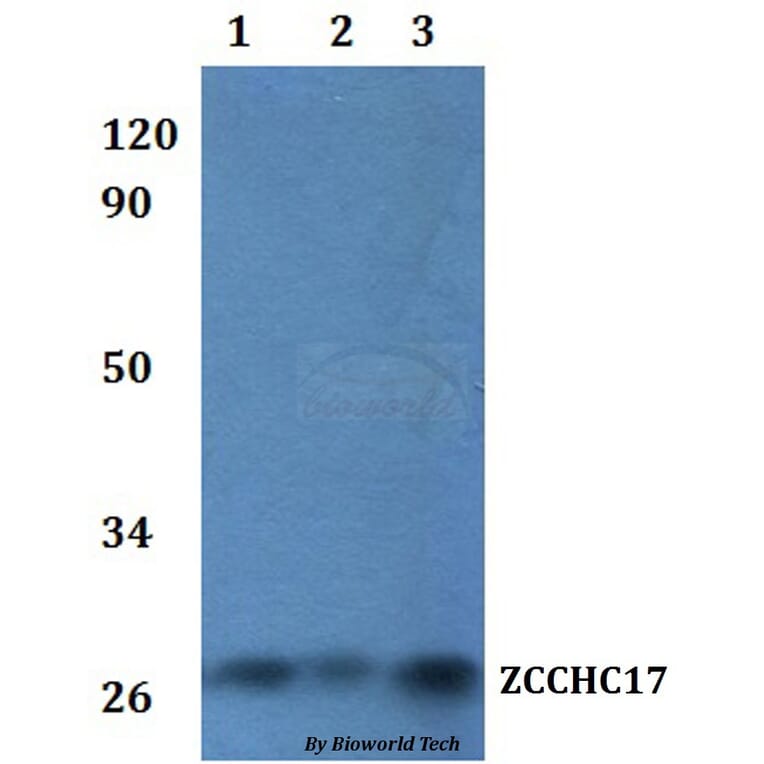 Anti-ZCCHC17 Antibody from Bioworld Technology (BS61229) - Antibodies.com