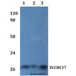 Anti-ZCCHC17 Antibody from Bioworld Technology (BS61229) - Antibodies.com