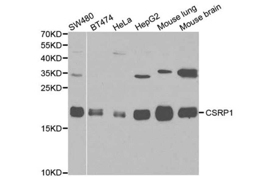 Anti-CSRP1 Antibody from Bioworld Technology (BS6123) - Antibodies.com