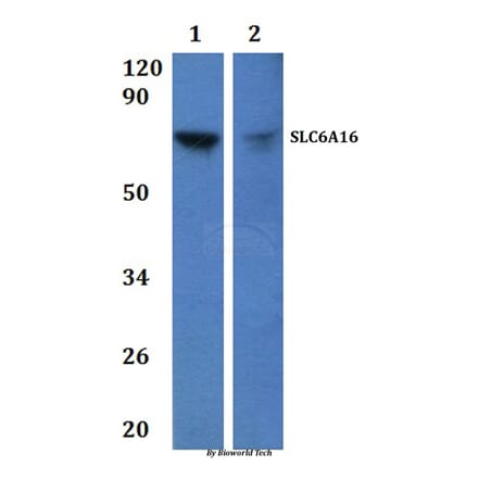 Anti-SLC6A16 Antibody from Bioworld Technology (BS61231) - Antibodies.com