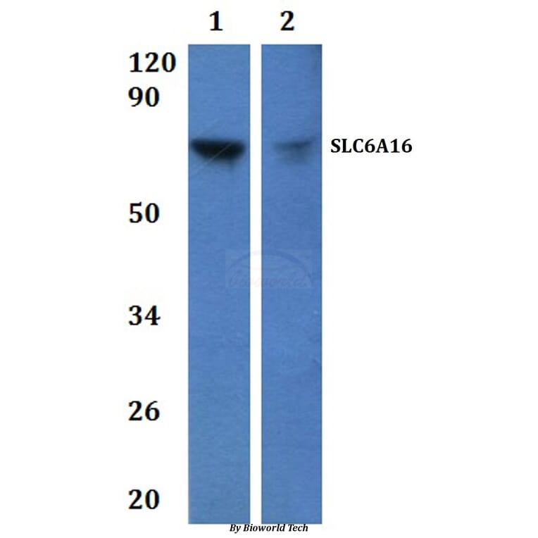 Anti-SLC6A16 Antibody from Bioworld Technology (BS61231) - Antibodies.com