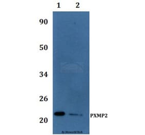 Anti-PXMP2 Antibody from Bioworld Technology (BS61233) - Antibodies.com