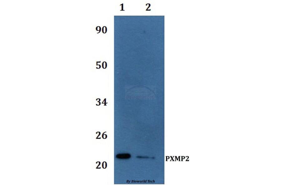 Anti-PXMP2 Antibody from Bioworld Technology (BS61233) - Antibodies.com
