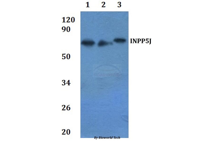 Anti-INPP5J Antibody from Bioworld Technology (BS61235) - Antibodies.com