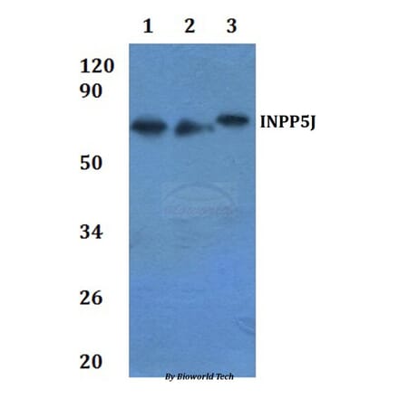 Anti-INPP5J Antibody from Bioworld Technology (BS61235) - Antibodies.com